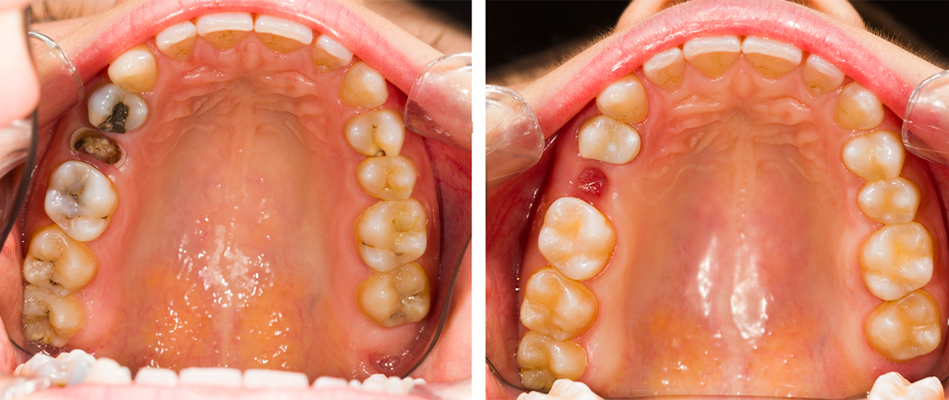 durin-surgery-simple-tooth-extraction-1