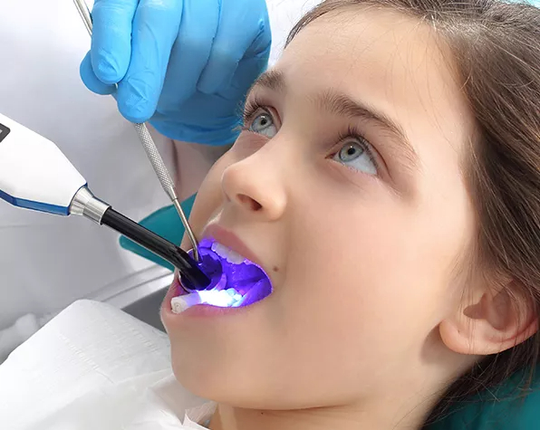 teeth-sealing-banner