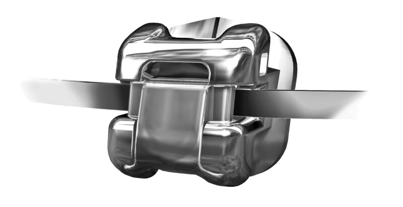 Damon-Q_Bracket_Wire
