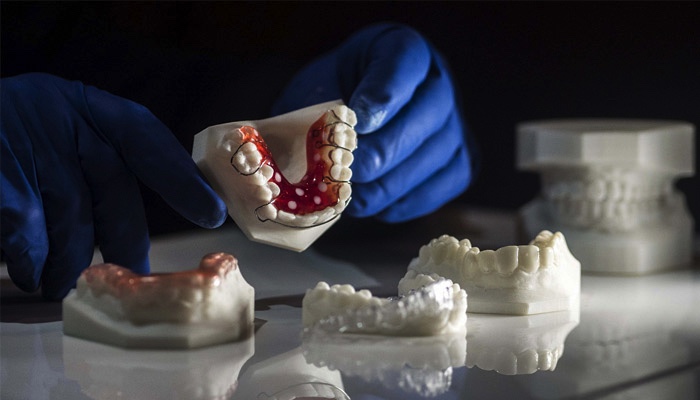 Impression 3D – Lixus Smile – Larache – Dental Clinic (2)