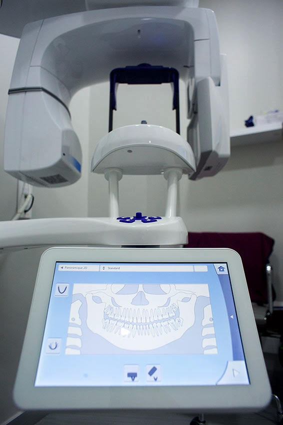 Scanner 3D cone beam – Lixus Smile – Larache – 1